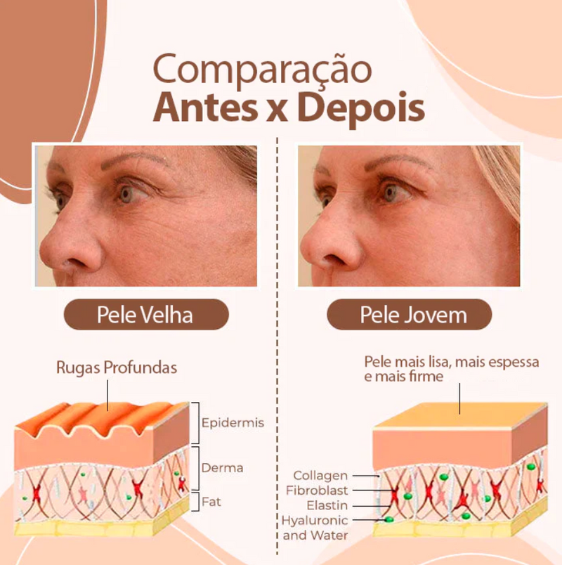 Bálsamo Derol Anti-Rugas (Restauração de Pele) - Modelo Batom